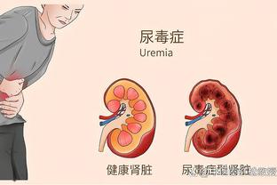 赖因德斯：本希望另一场的结果会不同 仍留在欧战之中很重要